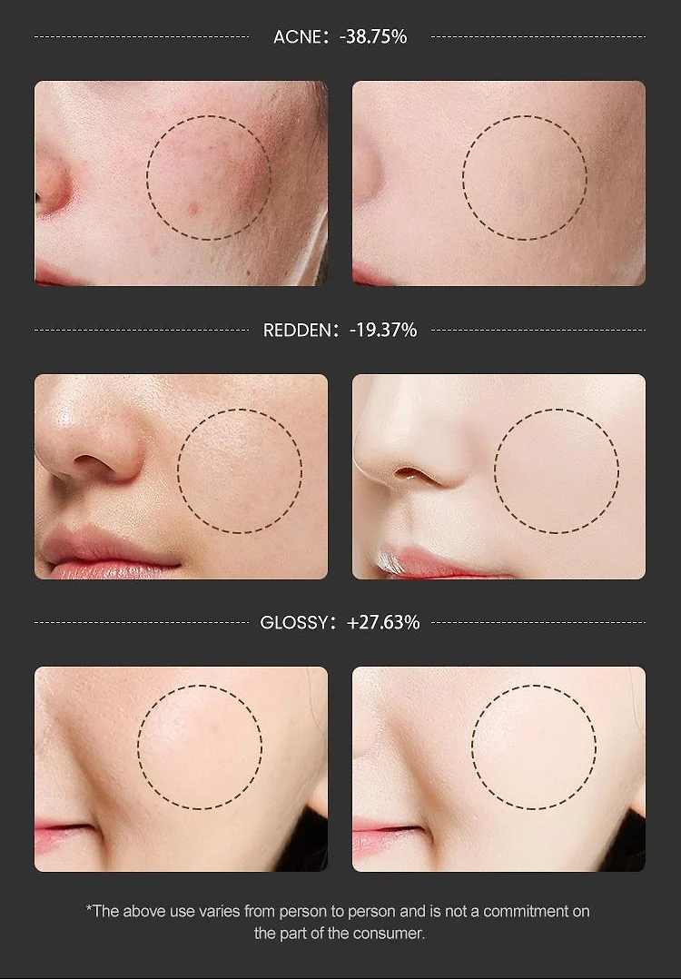 Red Light Therapy Mask with Vibration | EZLIFE